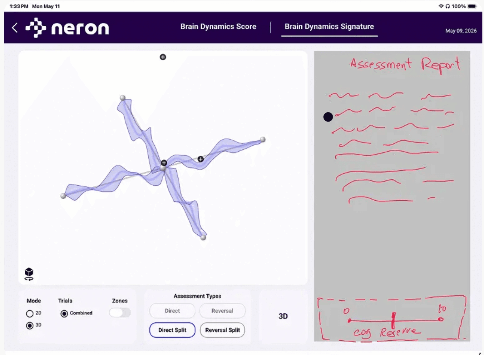 Annotated build screenshot reserving the right-hand panel for the assessment report, with a sketch of the cognitive reserve scale