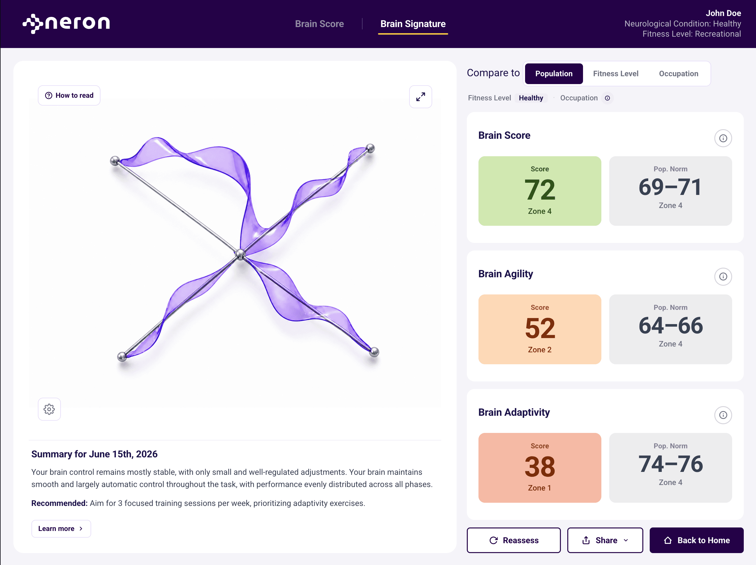 NERON Brain Dynamics Signature screen with 3D movement trajectory and population comparison